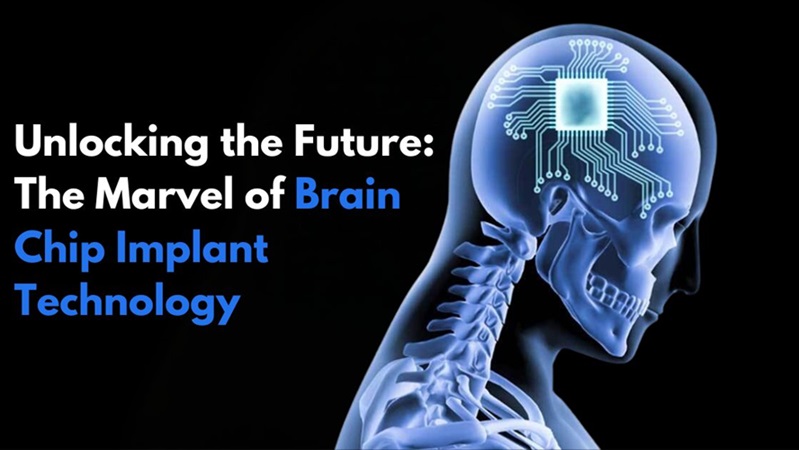 Unlocking the Future: The Marvel of Brain Chip Implant Technology